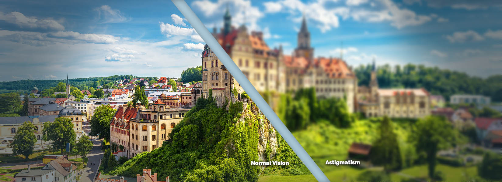 Astigmatism Treatment in La Vista