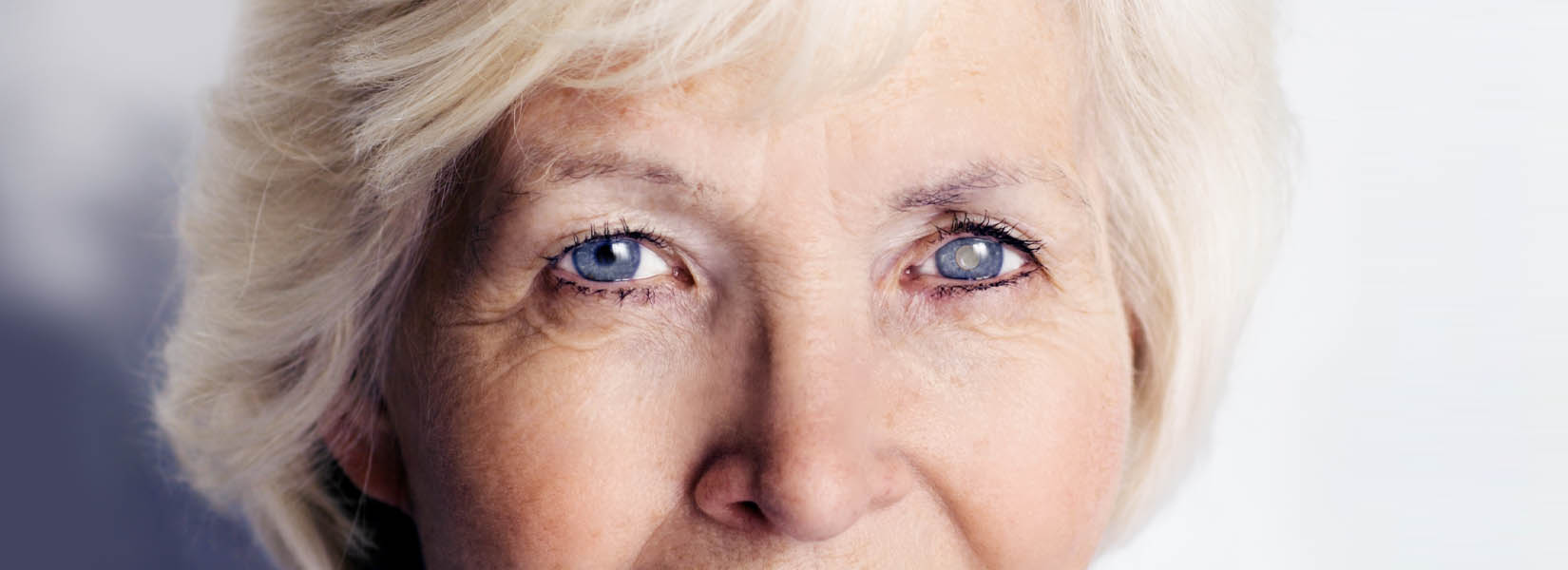 Cataract Surgery in La Vista